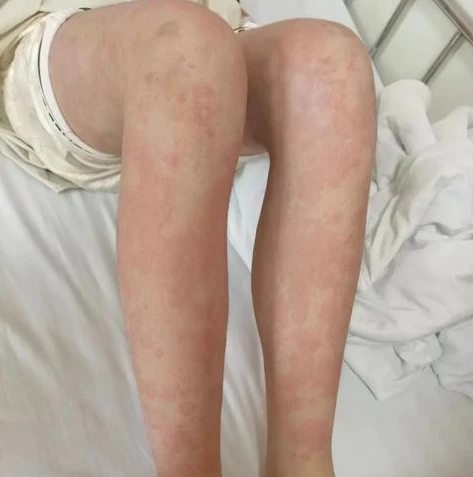 王者荣耀最新皮肤图片女生版_王者荣耀女生版最新皮肤全解析，绝美外观与独特魅力